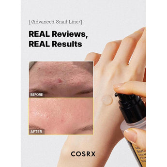 Advanced Snail 96 Mucin Power Essence - VivaVoss