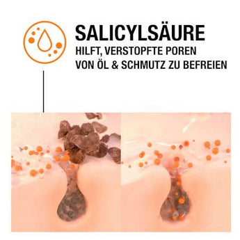 Anti Pickel Gel SOS Soforthilfe Neutrogena