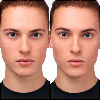 Concealer Serum Instant Bright 032N