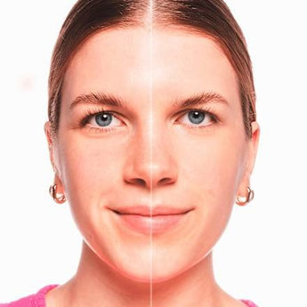 Concealer Skin Lovin' Sensitive 10 Light essence