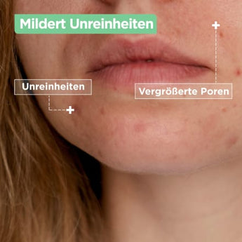 Gel - Creme mattierend Anti - Unreinheiten, 50 ml - VivaVoss