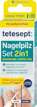 Nagelpilz Set 2in1 tetesept