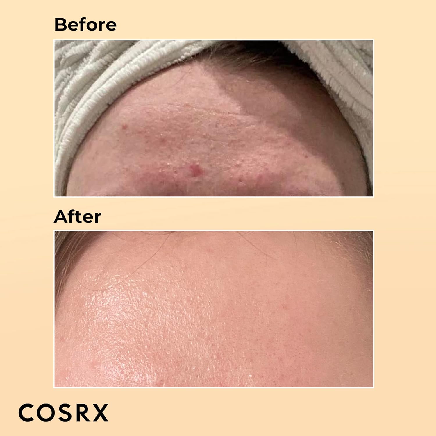 COSRX Advanced Snail 92% All in One Cream