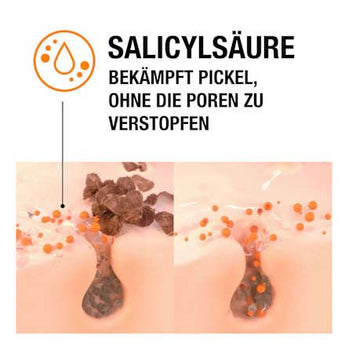 Anti Pickel Feuchtigkeitscreme Neutrogena