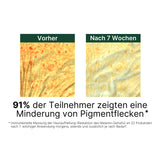 Vorher-Nachher-Vergleich der Haut mit Pigmentflecken vor und nach 7 Wochen Anwendung der Balea Handcreme Bright & Protect.