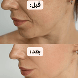 زهرة الفولين الياباني 