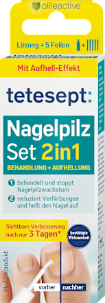Nagelpilz Set 2in1 tetesept
